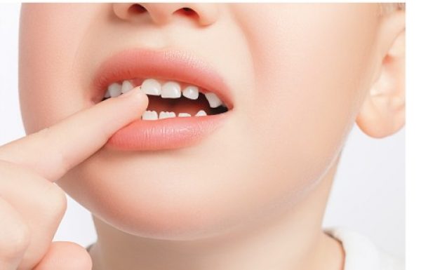 כיצד לשמור על שיני הילדים ומה לעשות בעת חבלה?